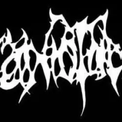 Craniotomy