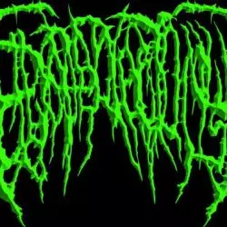 Epicardiectomy