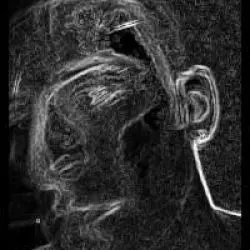 Monstrum Sepsis