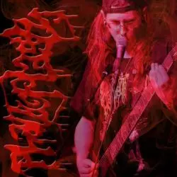 Phalloplasty