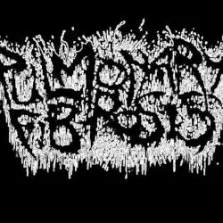 Pulmonary Fibrosis