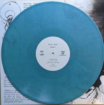 LP Anthony Green: Boom. Done.