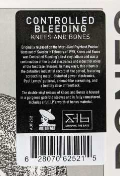 2LP Controlled Bleeding: Knees And Bones