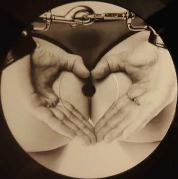 LP Coronary: Sinbad