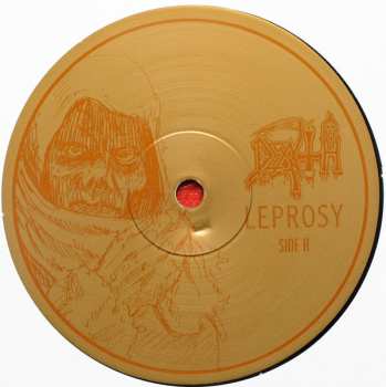 LP Death: Leprosy
