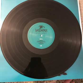 LP DREAMS: No One Defeats Us