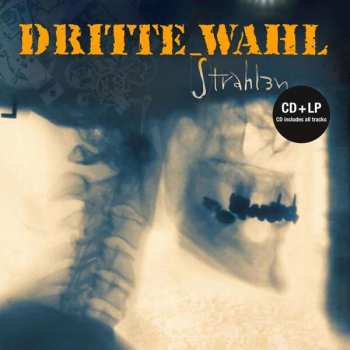 Album Dritte Wahl: Strahlen