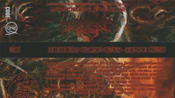 CD Intestinal Engorgement: Putrefying Consumption Of Dismemberment