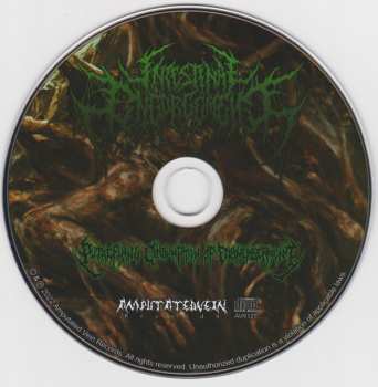 CD Intestinal Engorgement: Putrefying Consumption Of Dismemberment