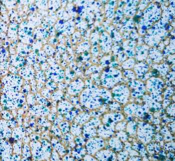 CD Ferenc Kiss: Magyar Kancionálé = Hungarian Cantionale - Zsoltárok, Népénekek = Psalms And Folk Hymns (Kálvin János Emlékere = In Memory Of Jean Calvin (1509-1564))