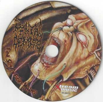 CD Mental Demise: Final Step To Future Madness