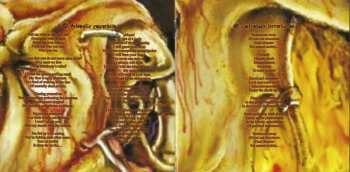 CD Mental Demise: Final Step To Future Madness