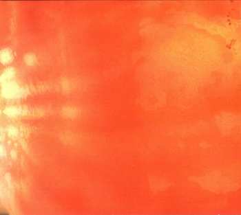 CD Meshuggah: Contradictions Collapse DLX | LTD | DIGI