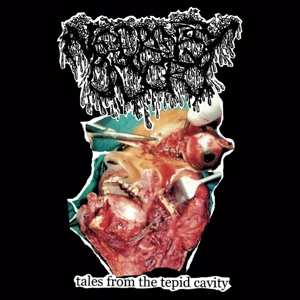 SP Necropsy Odor: Tales From The Tepid Cavity