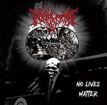 CD Nephrectomy: No Lives Matter