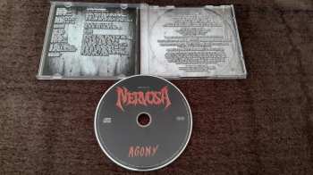 CD Nervosa: Agony
