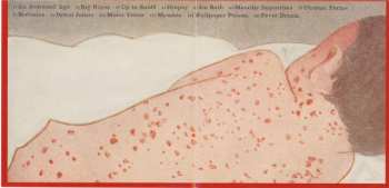 CD Nick Forté: Young Man's Disease