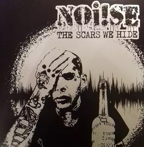 Noi!se: The Scars We Hide