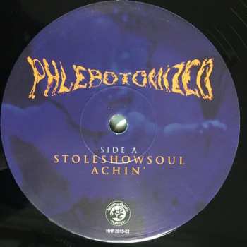 2LP Phlebotomized: Skycontact