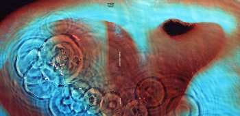 LP Pink Floyd: Meddle