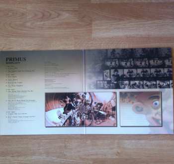 2LP Primus: Rhinoplasty LTD
