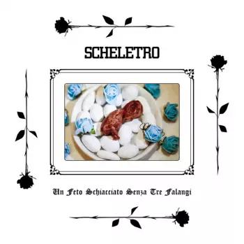 SCHELETRO: Un Feto Schiacciato Senza Tre Falangi