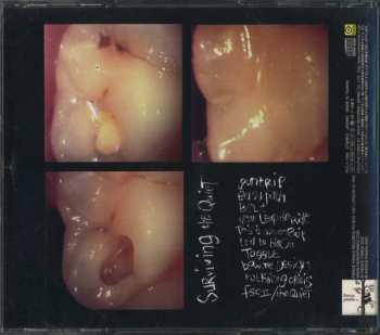 CD Seafood: Surviving The Quiet