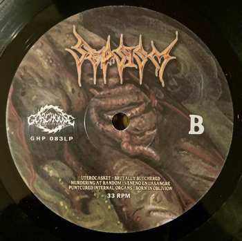 LP Sepsism: Purulent Decomposition