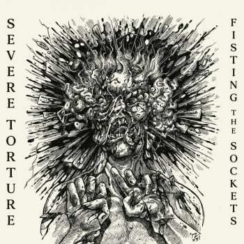 CD Severe Torture: Fisting The Sockets