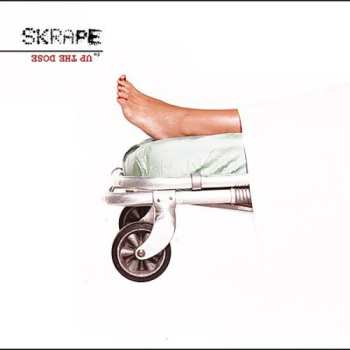 Album Skrape: Up The Dose