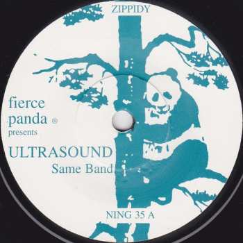 SP Ultrasound: Same Band